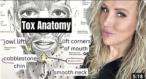Lower Face Botox Anatomy // DAO, Mentalis, Platysma