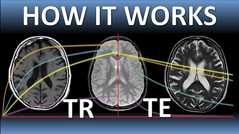 TR, TE & MRI Image Weighting EXPLAINED (Lecture 7)