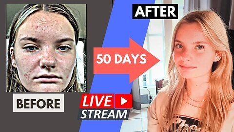 From Vegan to Carnivore: Teen's 50-Day Update Live Stream