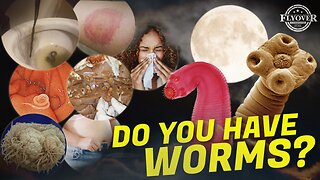 DO YOU HAVE WORMS? Bloating, Lymes, Tired, Hungry, Allergies, Gas, Drowsy after Eating, Struggles