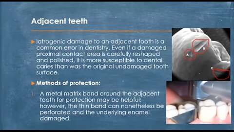 Operative L11 (Fixed Prosthodontics:Principles of Tooth Preparation Part1)