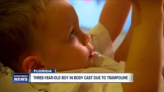 Three-year-old boy in body cast after trampoline-related injury