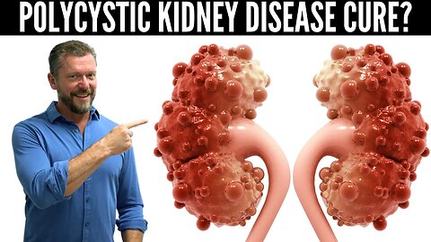 Polycystic Kidney Disease Breakthrough (New Research in PKD) - 2023