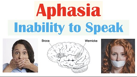 Aphasia | Types (Broca’s, Wernicke’s, Global), Causes, Signs & Symptoms, Diagnosis, Treatment