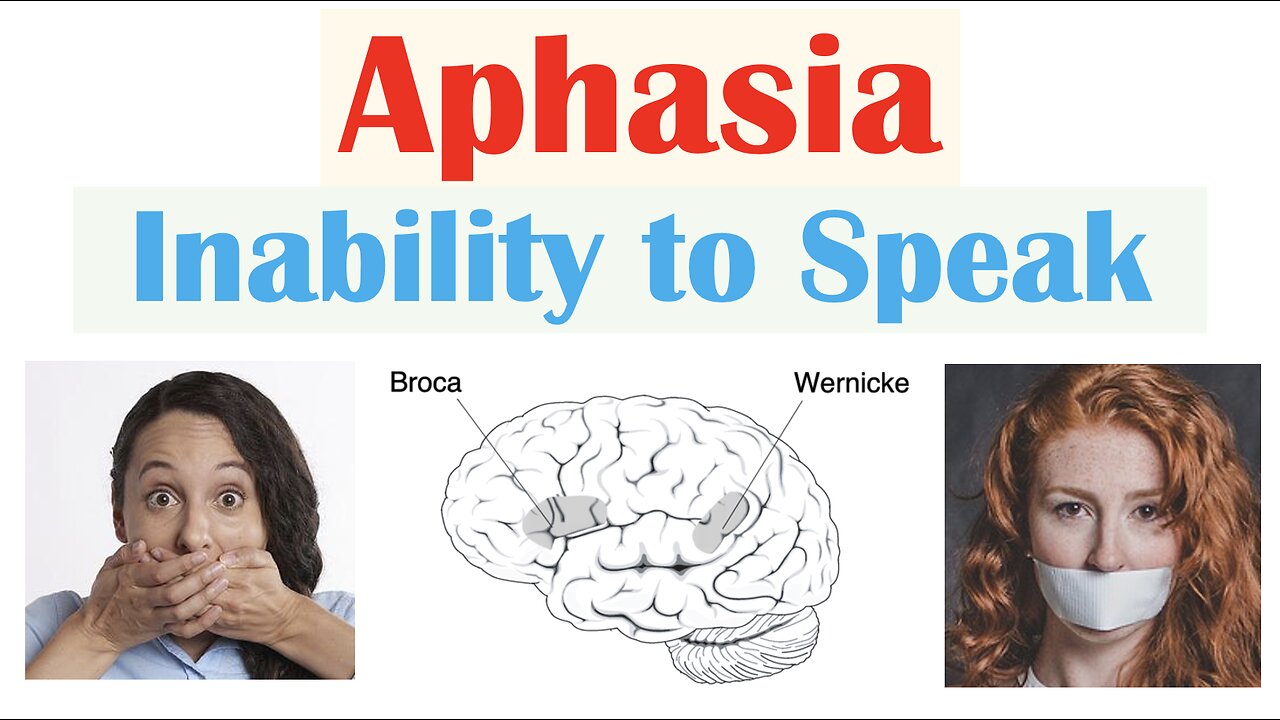 Aphasia | Types (Broca’s, Wernicke’s, Global), Causes, Signs & Symptoms ...