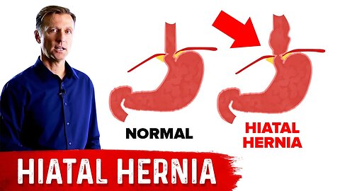 Hiatal Hernia: The Best Home Treatment