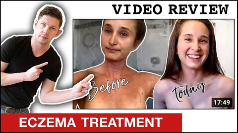 How To Heal Eczema Naturally - MissFitAndNerdy video review
