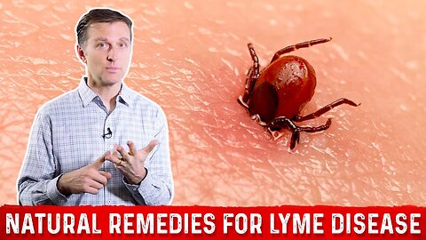 Lyme Disease Natural Remedies and Treatment – Dr. Berg