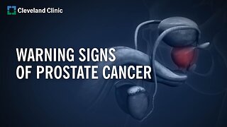 10 WARNING SIGNS OF PROSTATE CANCER