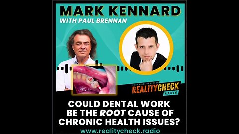 Could Dental Work Be The Root Cause Of Chronic Health Issues