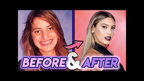 Lele Pons | Before and After Transformations | GLOW UP