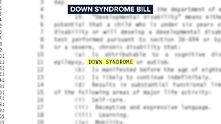 Arizonans advocate to include Down Syndrome as a qualifying disability for services