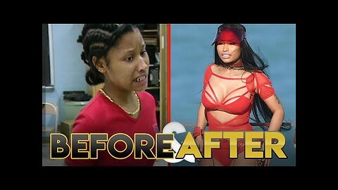 NICKI MINAJ | Before & After Transformation ( Plastic Surgery, Makeup & More )