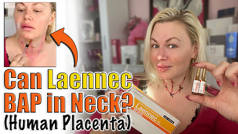 Can you BAP Laennec in the NECK? Let's TEST from Acecosm.com | Code Jessica10 Saves you Money
