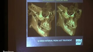 Phil Mollica, DMD, NMD, MIAOMT presents "Part 1 of Fundamentals of Biological Dentistry"