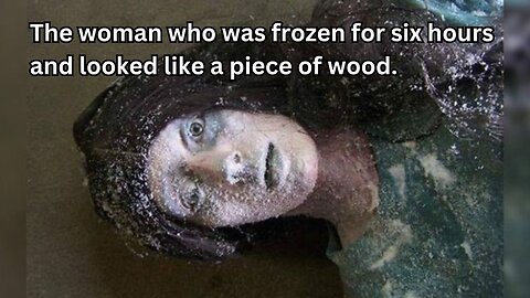 The woman who was frozen for six hours and looked like a piece of wood.