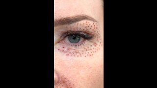14 Day RECOVERY Plasma Fibroblast Eye Tightening: JOIN Natural Kaos Skincare APP