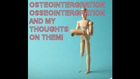 EPISODE 2 Osteointegration/ Osseointegration and my thoughts on them!