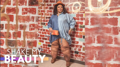 I've Hidden My Lipedema Legs - Until Today | SHAKE MY BEAUTY