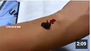 Leeches die 3 days after feeding on vaccinated blood