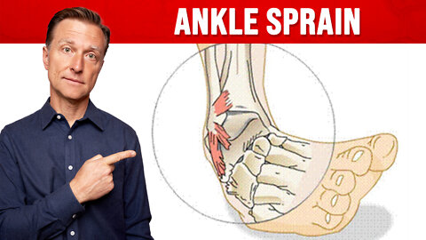 Is Your OLD ANKLE SPRAIN Still Bothering You?