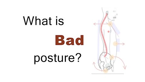 What is Bad Posture? (And why does it matter?)