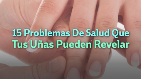 15 Problemas De Salud Que Tus Uñas Pueden Revelar