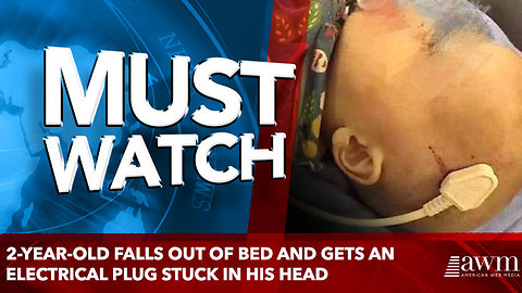 2-Year-Old Falls Out Of Bed And Gets An Electrical Plug Stuck In His Head