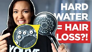 Hard Water: Does it Cause Hair Loss ? + (BEST Shower Filter for Hard Water)