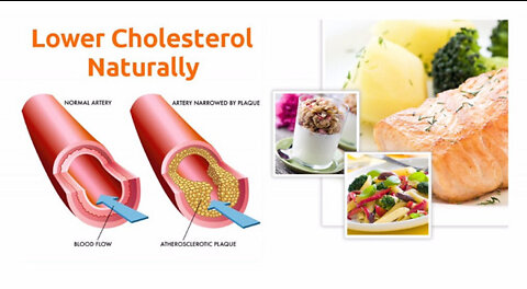 Cholesterol - Use Foods To Lower LDL Cholesterol