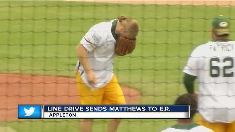 Packers' Clay Matthews to have surgery on nose after taking line drive to face