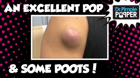 An Excellent POP & some poots...