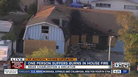 1 person injured in house fire