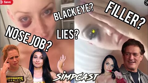 Is Eliza Bleu LYING About "Black Eyes"? Anthony Cumia, Chrissie Mayr Anna TSWG & SimpCast Speculate