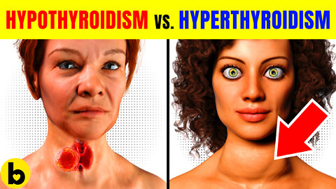 Hypothyroidism Vs. Hyperthyroidism: What's The Difference?