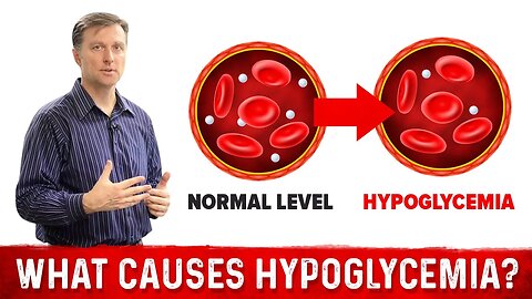 What Causes Hypoglycemia? – Dr.Berg