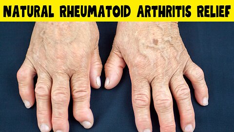 10 Natural Remedies for Rheumatoid Arthritis Pain