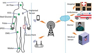 Wireless Body Area Network Pt1