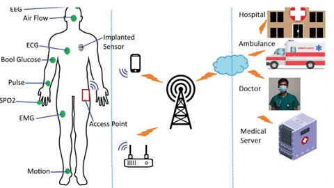 Wireless Body Area Network Pt1