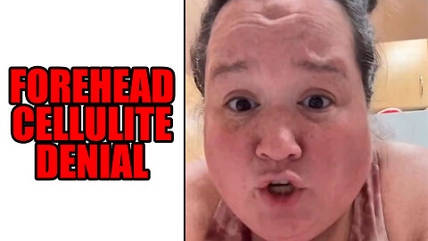 A Woman So Fat She Has Cellulite On Her Forehead Gives Health and Weight Advice