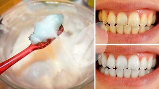 COMO CLAREAR NATURALMENTE OS DENTES EM CASA EM 3 MINUTOS