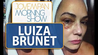 Luiza Brunet aparece com olho roxo em foto após agressão | Morning Show