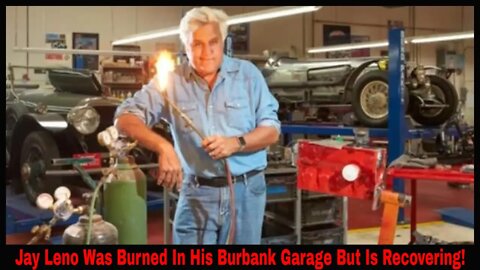 Jay Leno Was Burned In His Burbank Garage But Is Recovering!