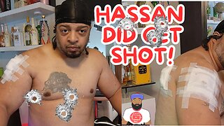 Proof Hassan Campbell Really Got Shot | Meek Mill Send Shots At Trippy Redd