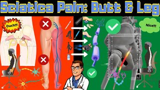 How To Cure Sciatica Permanently [Treatment, Stretches, Exercises]