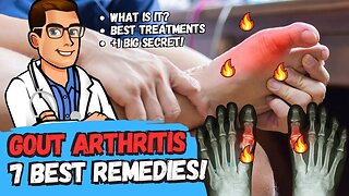 🔥Top 7 Gout Foot & Big Toe HOME Treatments [+1 BIG SECRET]