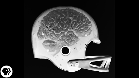 S2 Ep33: Are Concussions Deadly?