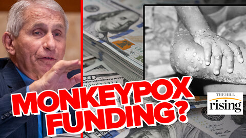 Anthony Fauci's NIAID Received $10 Million MONKEYPOX Research Grant Last Year