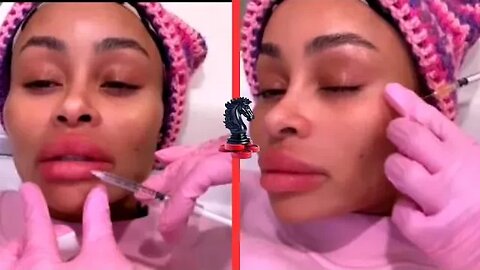 Blac Chyna Gets Lip and Cheek Fillers REMOVED