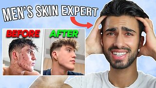 Men's Skin Expert Reacts To Joe Fazer "How I Cleared My Acne"